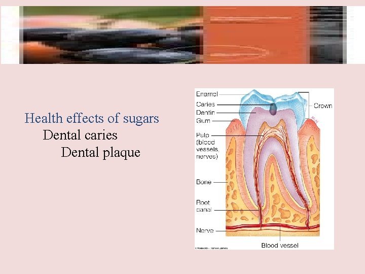 Health effects of sugars Dental caries Dental plaque 