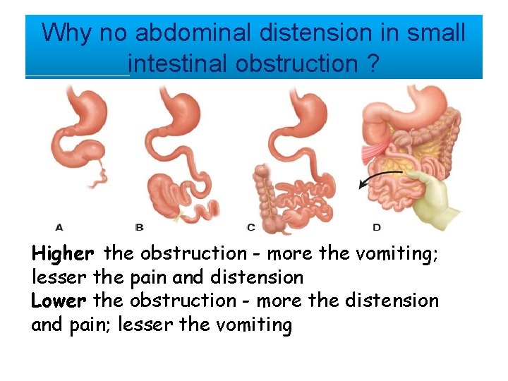 Why no abdominal distension in small intestinal obstruction ? Higher the obstruction - more