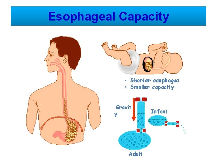 Esophageal Capacity • Shorter esophagus • Smaller capacity Gravit y Adult Infant 