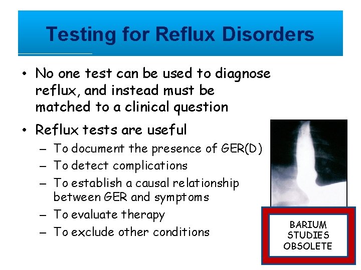 Testing for Reflux Disorders • No one test can be used to diagnose reflux,