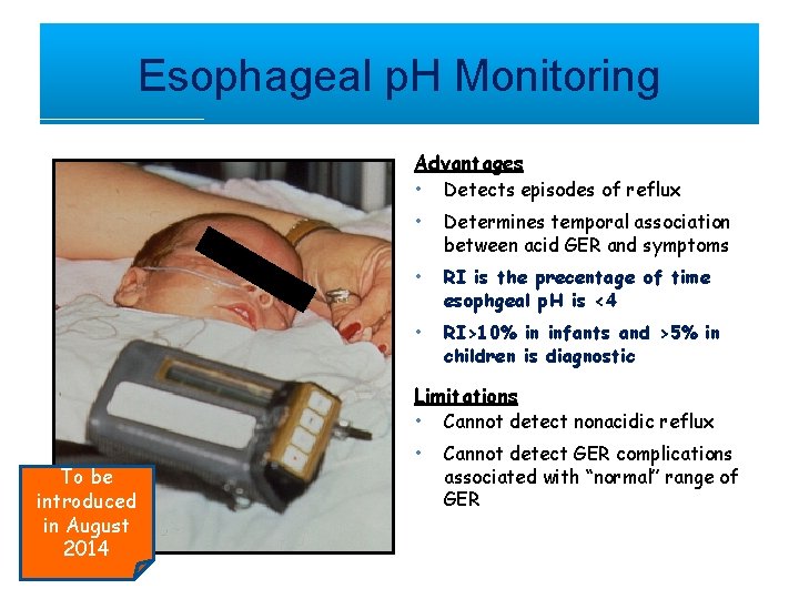 Esophageal p. H Monitoring Advantages • Detects episodes of reflux • Determines temporal association