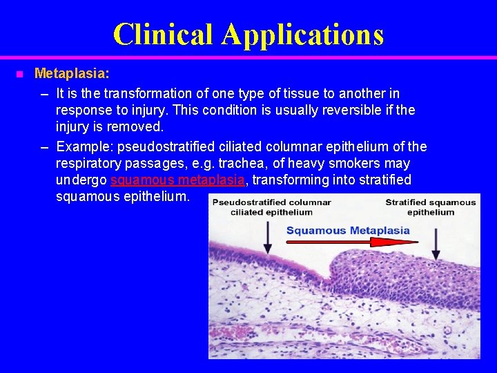 Clinical Applications n Metaplasia: – It is the transformation of one type of tissue