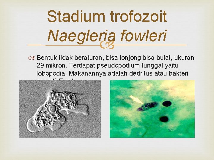 Stadium trofozoit Naegleria fowleri Bentuk tidak beraturan, bisa lonjong bisa bulat, ukuran 29 mikron.