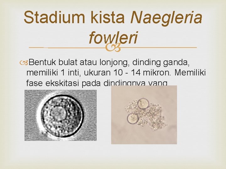 Stadium kista Naegleria fowleri Bentuk bulat atau lonjong, dinding ganda, memiliki 1 inti, ukuran