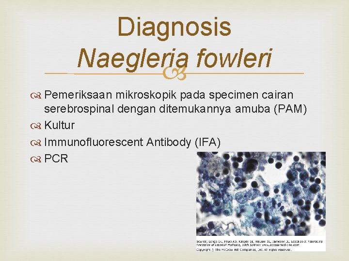 Diagnosis Naegleria fowleri Pemeriksaan mikroskopik pada specimen cairan serebrospinal dengan ditemukannya amuba (PAM) Kultur