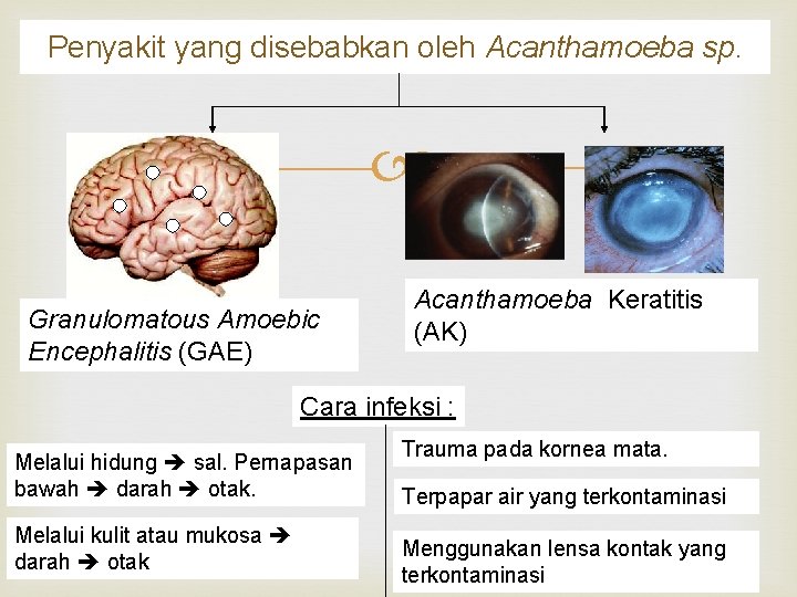 Penyakit yang disebabkan oleh Acanthamoeba sp. Granulomatous Amoebic Encephalitis (GAE) Acanthamoeba Keratitis (AK) Cara