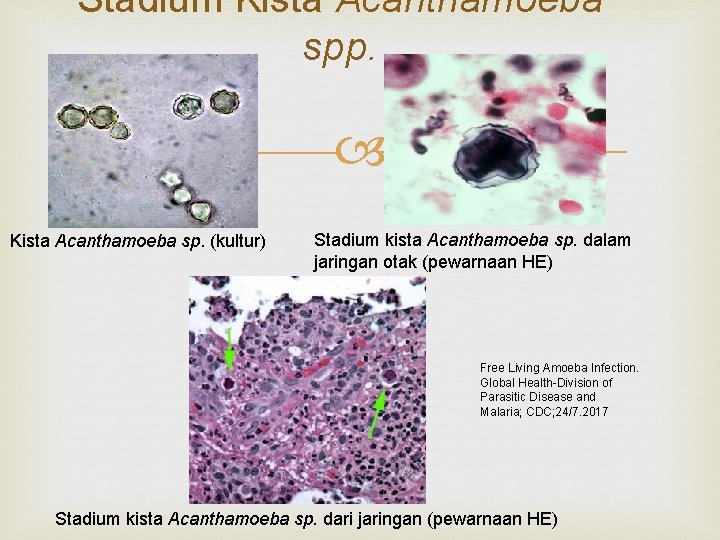 Stadium Kista Acanthamoeba spp. Kista Acanthamoeba sp. (kultur) Stadium kista Acanthamoeba sp. dalam jaringan