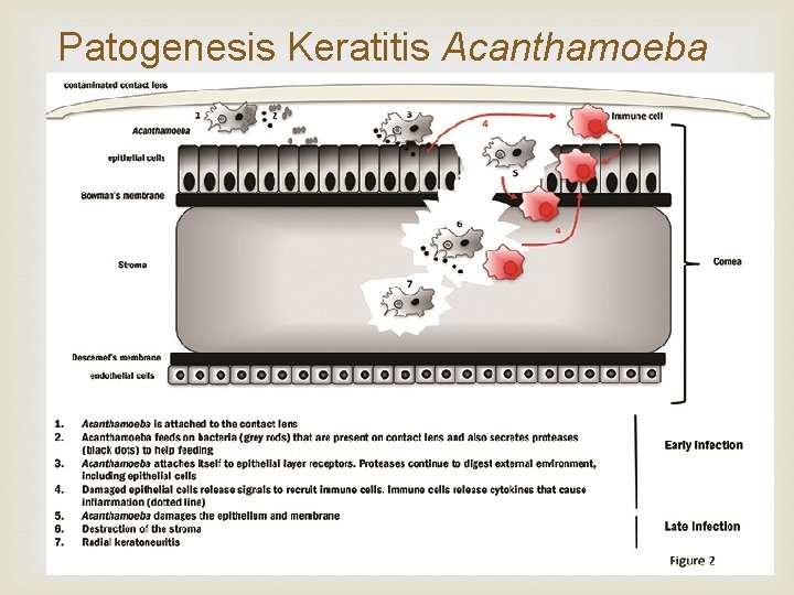 Patogenesis Keratitis Acanthamoeba 