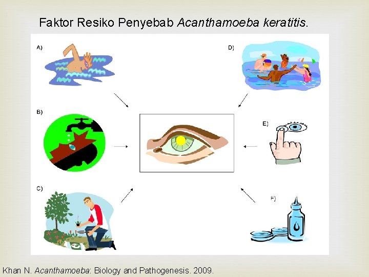 Faktor Resiko Penyebab Acanthamoeba keratitis. Khan N. Acanthamoeba: Biology and Pathogenesis. 2009. 