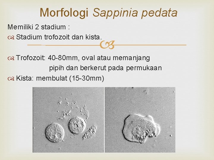 Morfologi Sappinia pedata Memiliki 2 stadium : Stadium trofozoit dan kista. Trofozoit: 40 -80