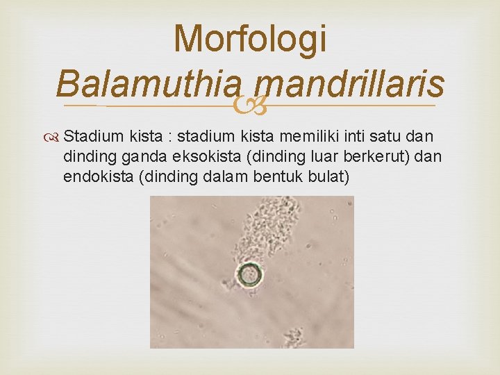 Morfologi Balamuthia mandrillaris Stadium kista : stadium kista memiliki inti satu dan dinding ganda