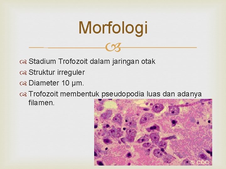 Morfologi Stadium Trofozoit dalam jaringan otak Struktur irreguler Diameter 10 µm. Trofozoit membentuk pseudopodia