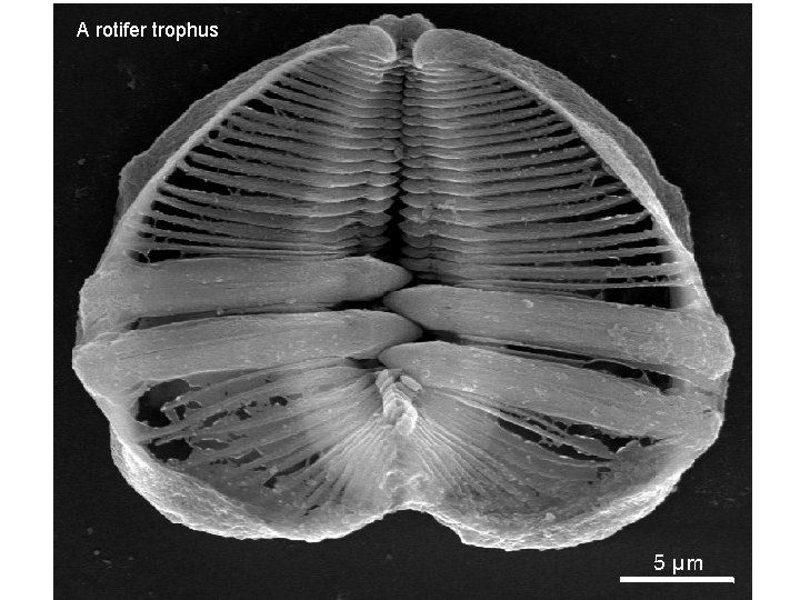 A rotifer trophus 