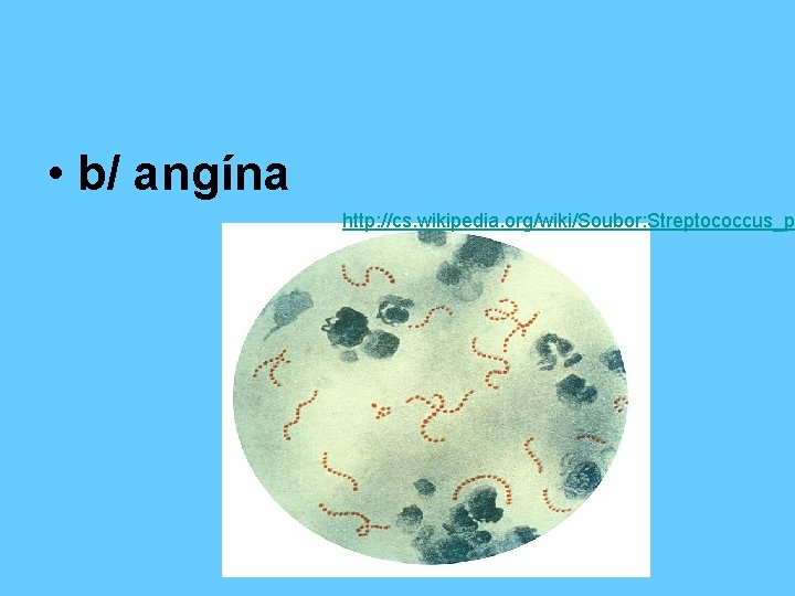  • b/ angína http: //cs. wikipedia. org/wiki/Soubor: Streptococcus_p 