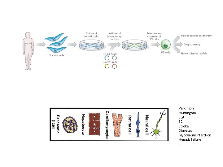 Parkinson Huntington SLA SCI Stroke Diabetes Myocardial infarction Hepatic failure … 