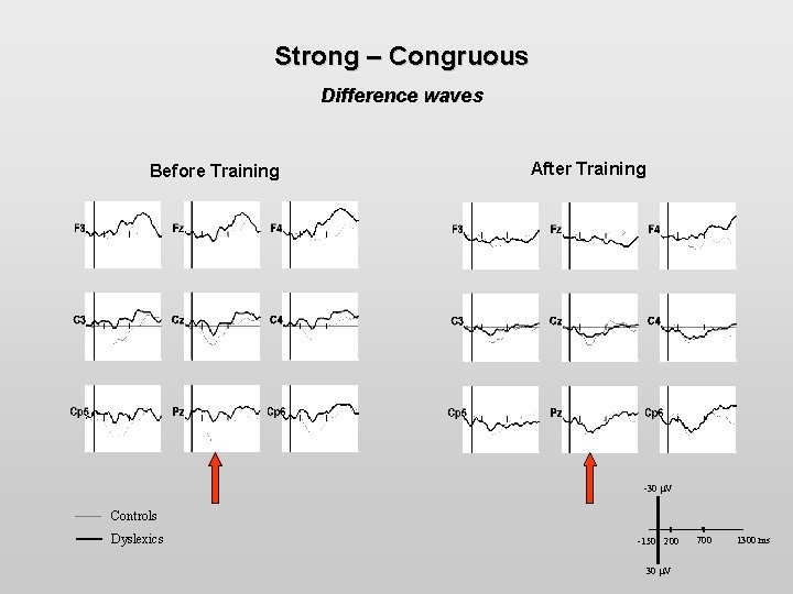 Strong – Congruous Difference waves Before Training After Training -30 V Controls Dyslexics -150