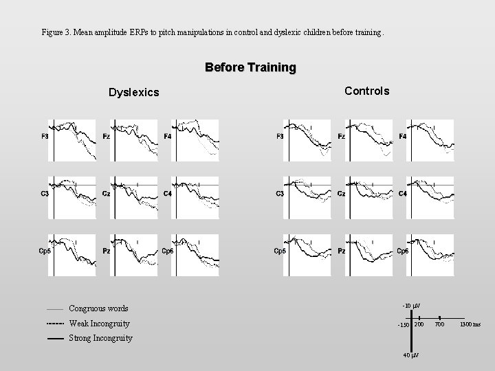 Figure 3. Mean amplitude ERPs to pitch manipulations in control and dyslexic children before