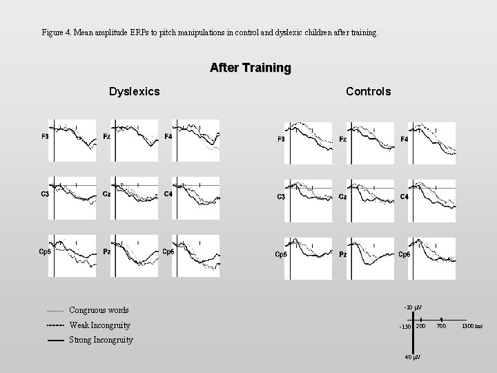 Figure 4. Mean amplitude ERPs to pitch manipulations in control and dyslexic children after