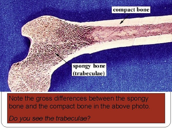 Note the gross differences between the spongy bone and the compact bone in the Note the gross differences between the spongy bone and the compact bone in the