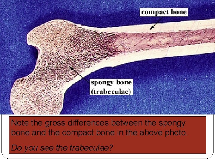 Note the gross differences between the spongy bone and the compact bone in the