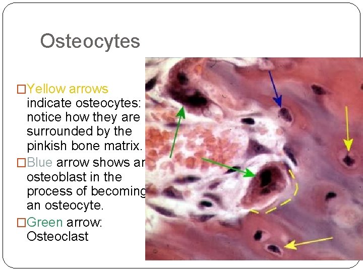 Osteocytes �Yellow arrows indicate osteocytes: notice how they are surrounded by the pinkish bone