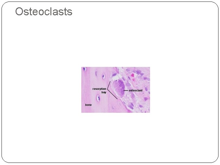 Osteoclasts 38 Osteoclasts 38