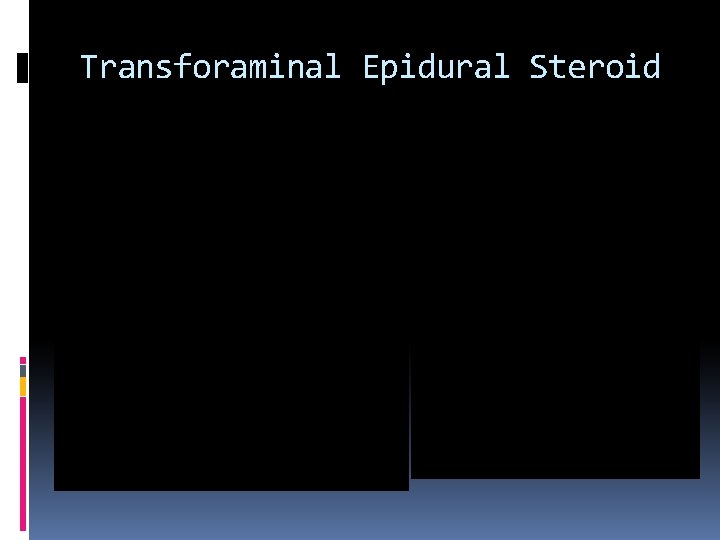 Transforaminal Epidural Steroid 