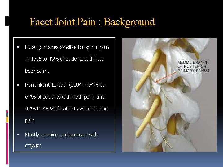Facet Joint Pain : Background Facet joints responsible for spinal pain in 15% to