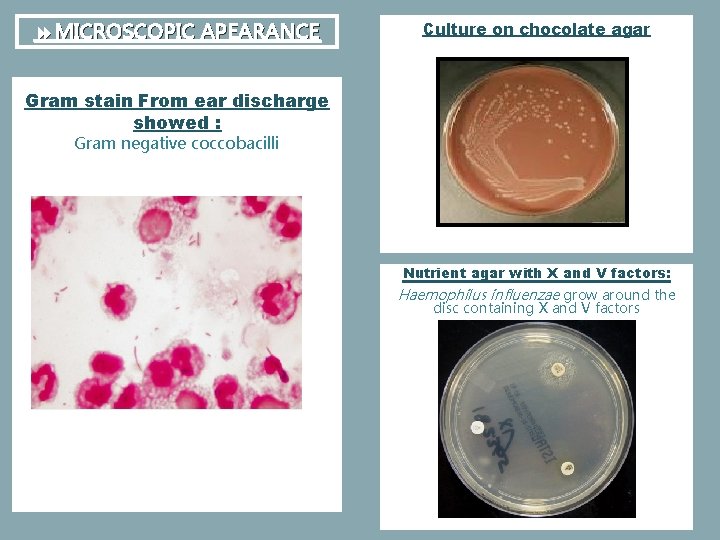  MICROSCOPIC APEARANCE Culture on chocolate agar Gram stain From ear discharge showed :