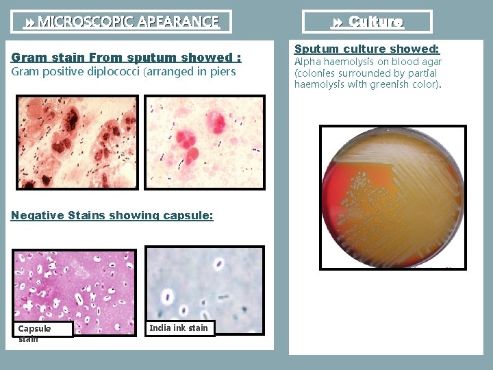  MICROSCOPIC APEARANCE Gram stain From sputum showed : Gram positive diplococci (arranged in