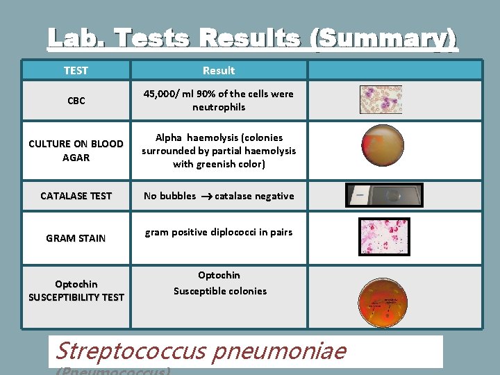 Lab. Tests Results (Summary) TEST Result CBC 45, 000/ ml 90% of the cells
