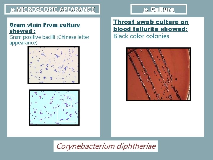  MICROSCOPIC APEARANCE Gram stain From culture showed : Gram positive bacilli (Chinese letter