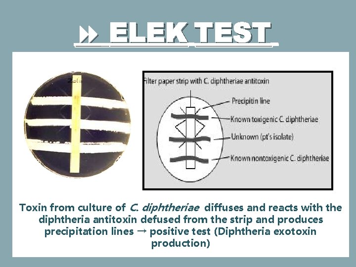 ELEK TEST Toxin from culture of C. diphtheriae diffuses and reacts with the