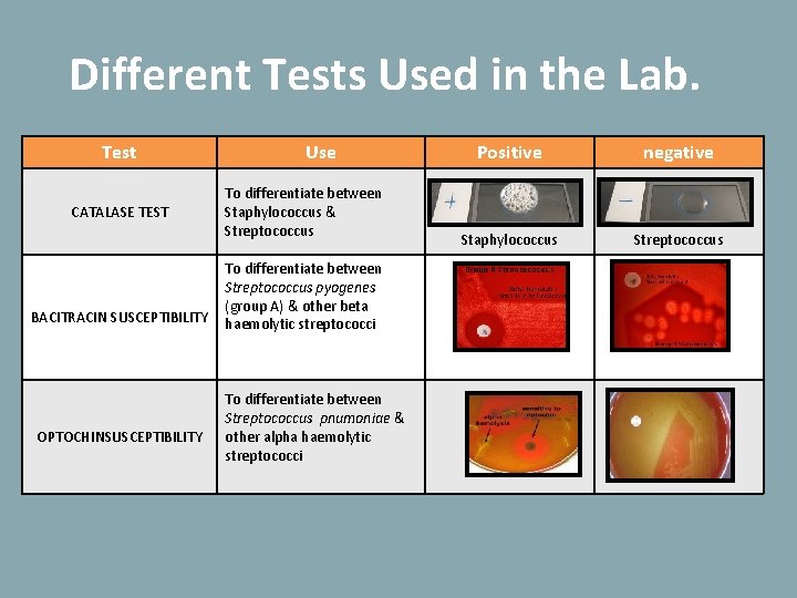 Different Tests Used in the Lab. Test CATALASE TEST BACITRACIN SUSCEPTIBILITY OPTOCHINSUSCEPTIBILITY Use To