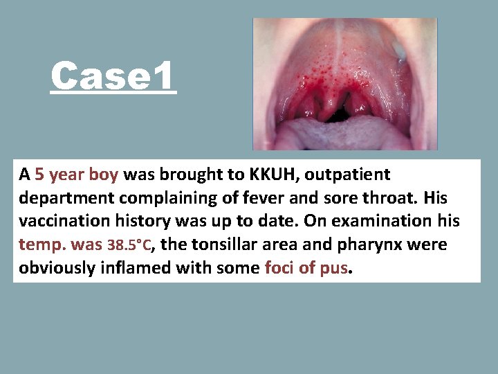 Case 1 A 5 year boy was brought to KKUH, outpatient department complaining of