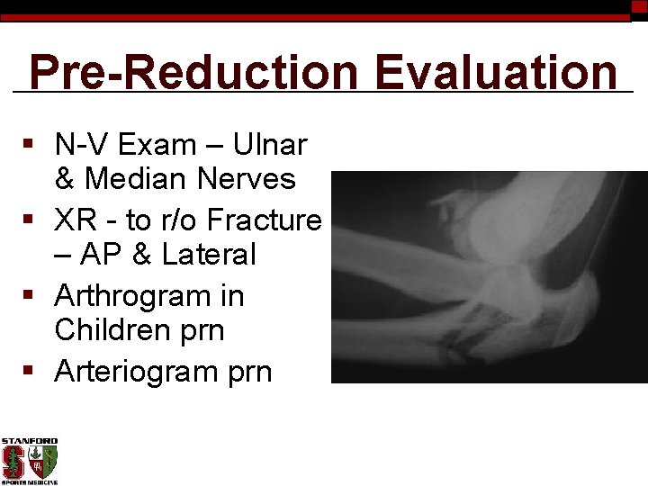 Pre-Reduction Evaluation § N-V Exam – Ulnar & Median Nerves § XR - to