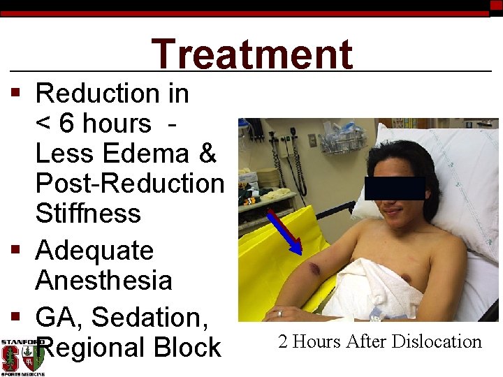 Treatment § Reduction in < 6 hours Less Edema & Post-Reduction Stiffness § Adequate
