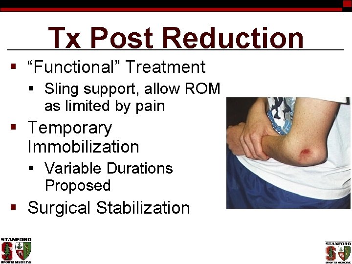 Tx Post Reduction § “Functional” Treatment § Sling support, allow ROM as limited by