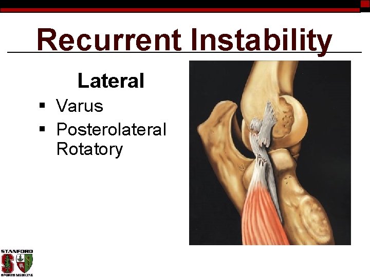 Recurrent Instability Lateral § Varus § Posterolateral Rotatory 