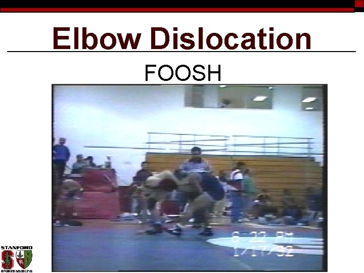 Elbow Dislocation FOOSH 