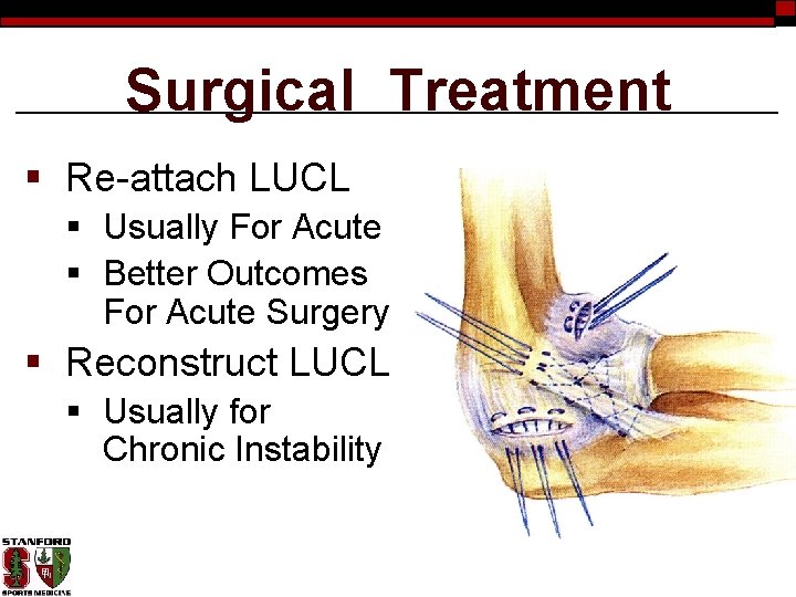 Surgical Treatment § Re-attach LUCL § Usually For Acute § Better Outcomes For Acute