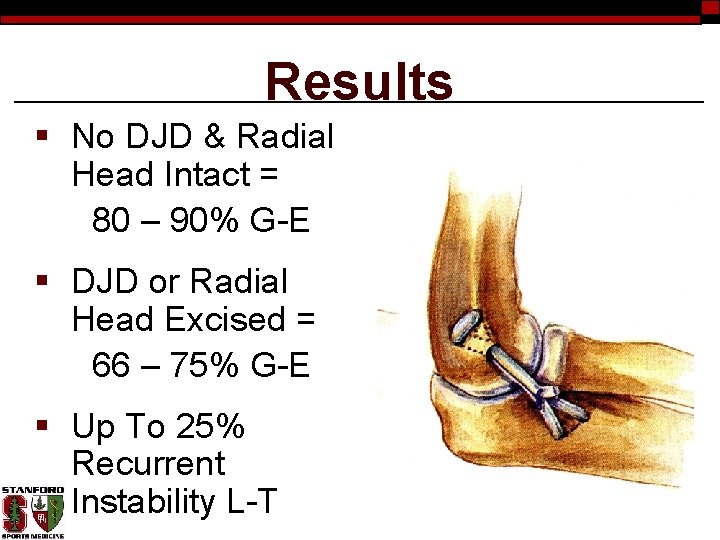 Results § No DJD & Radial Head Intact = 80 – 90% G-E §