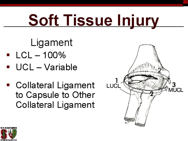 Soft Tissue Injury Ligament § LCL – 100% § UCL – Variable § Collateral