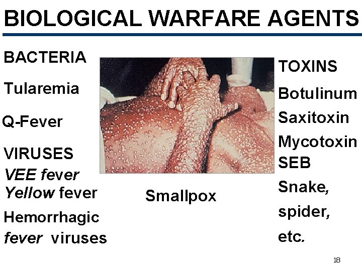 BIOLOGICAL WARFARE AGENTS BACTERIA Anthrax Tularemia Plague Q-Fever VIRUSES VEE fever Yellow fever Hemorrhagic