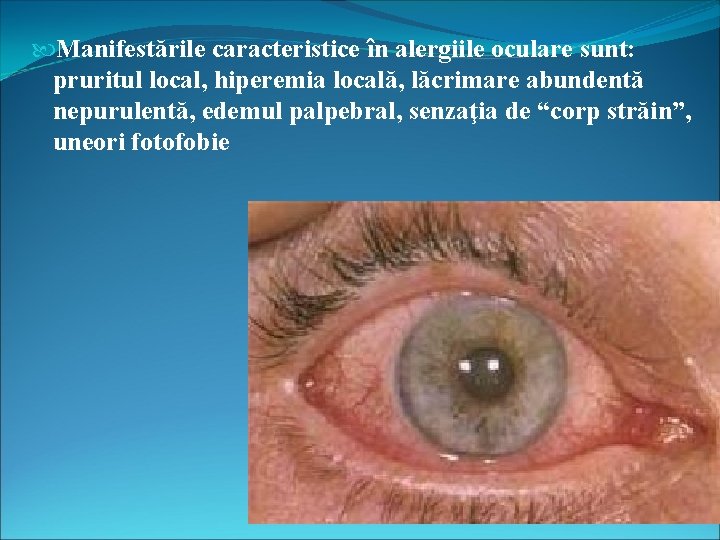  Manifestările caracteristice în alergiile oculare sunt: pruritul local, hiperemia locală, lăcrimare abundentă nepurulentă,