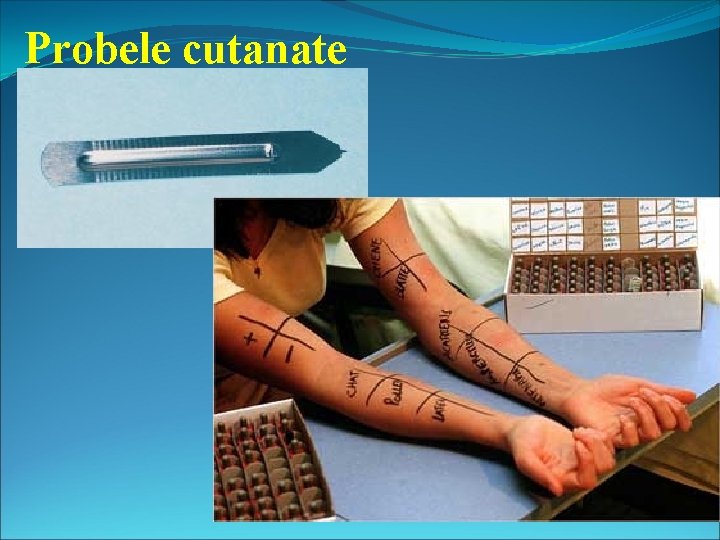 Probele cutanate 