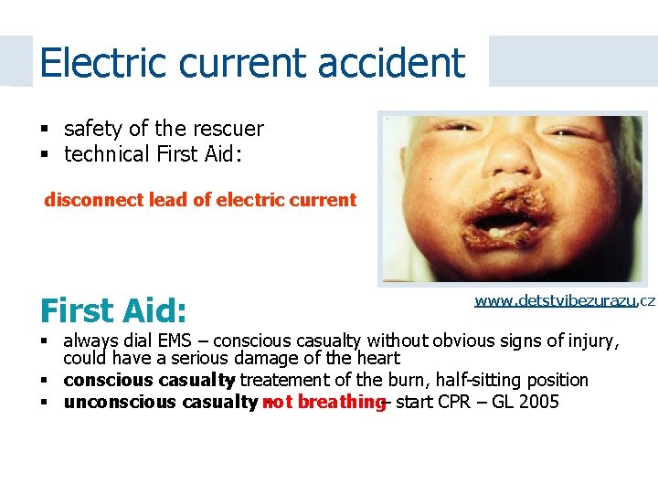 Electric current accident safety of the rescuer technical First Aid: disconnect lead of electric