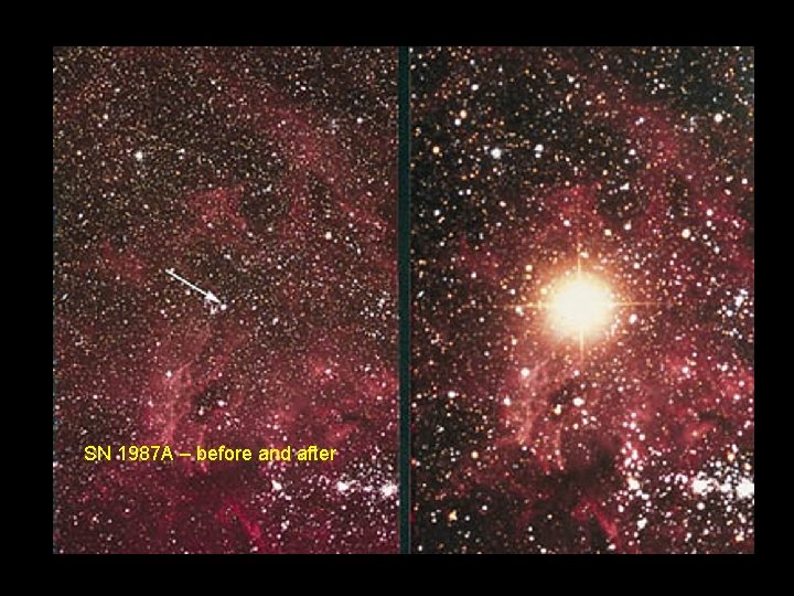SN 1987 A – before and after 