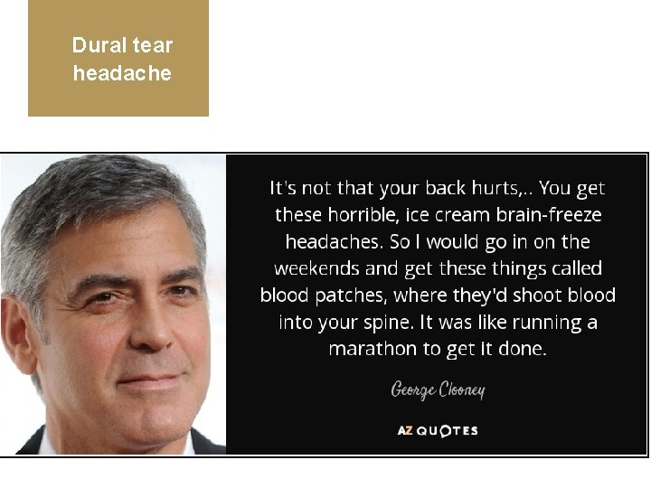 Dural tear headache 