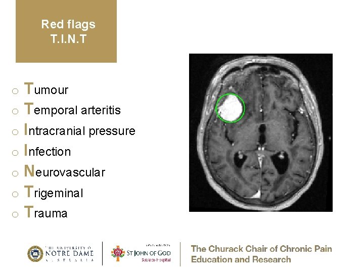 Red flags T. I. N. T Tumour o Temporal arteritis o Intracranial pressure o